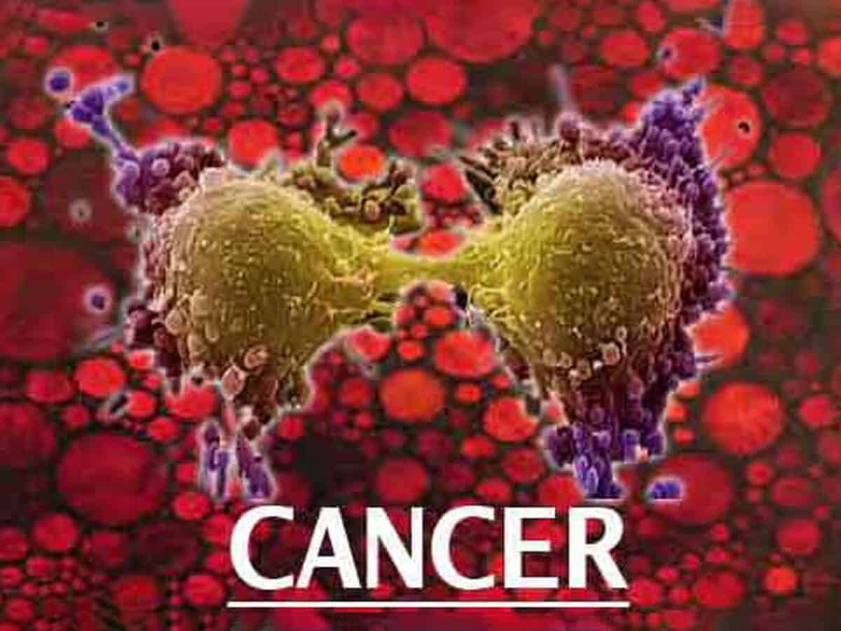 Cancer to be A Major Disease in India: Change in Lifestyle Main Culprit