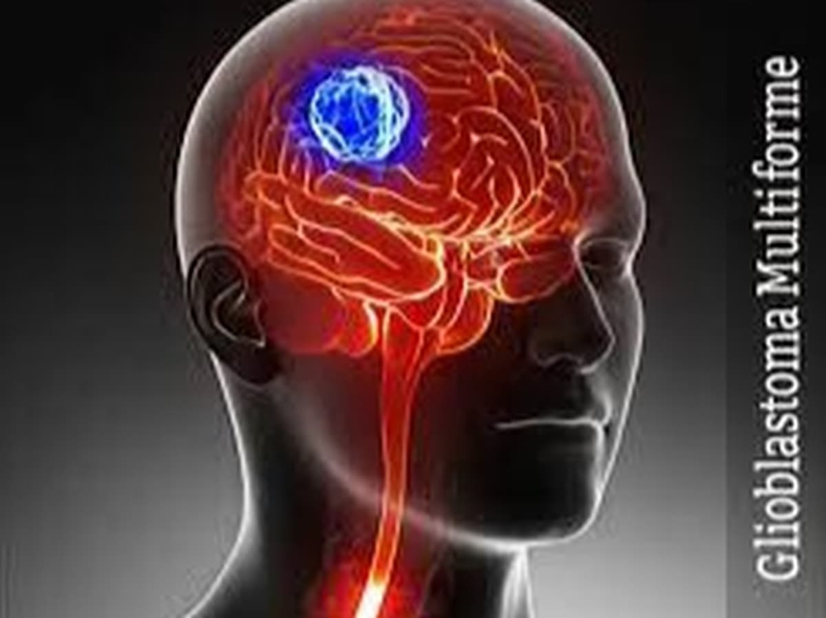 Glioblastoma (GBM) Awareness Day