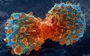 Lifestyle change and Cancer