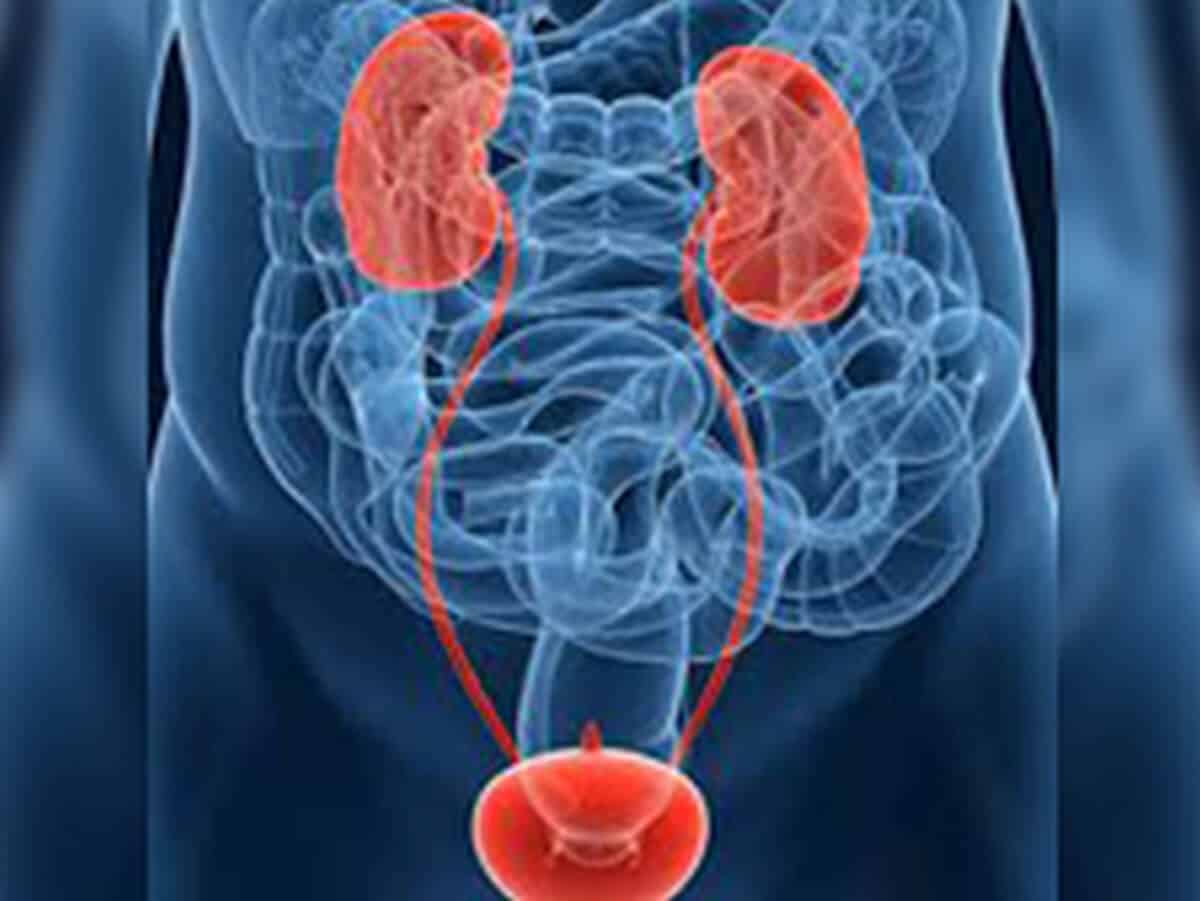 The Silent Killer: Case Of Bladder Cancer